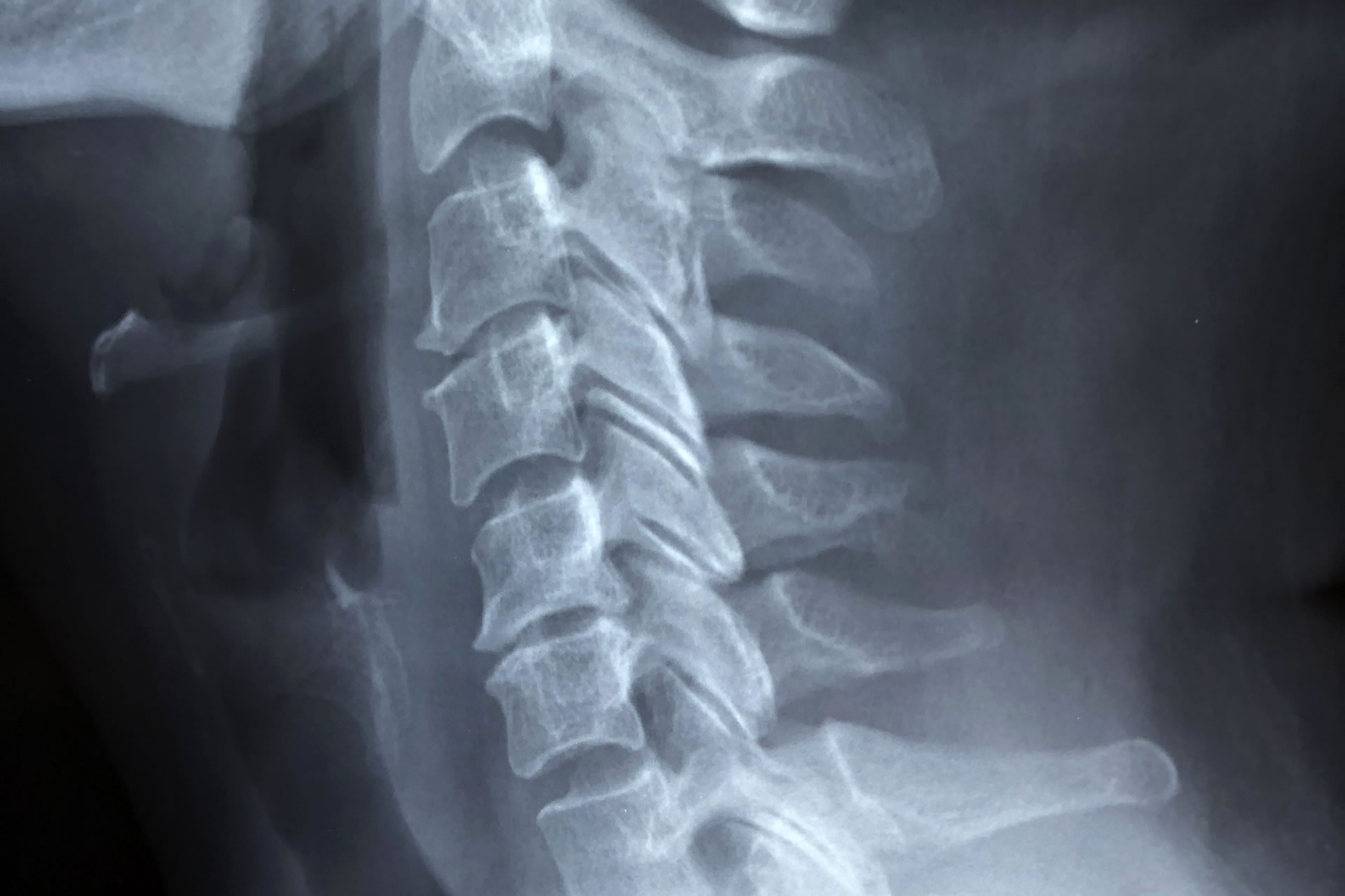 x-ray of human neck